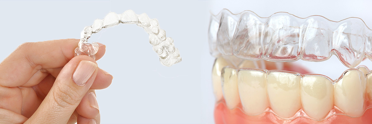 Peoria Alternative to Braces for Teens
