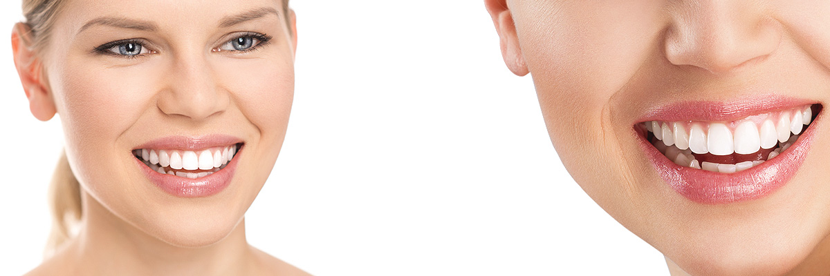 Peoria Cosmetic Dental Services