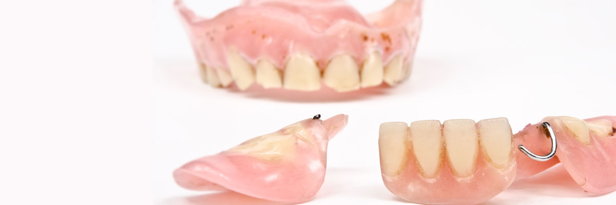 Peoria What Do I Do If I Damage My Dentures?