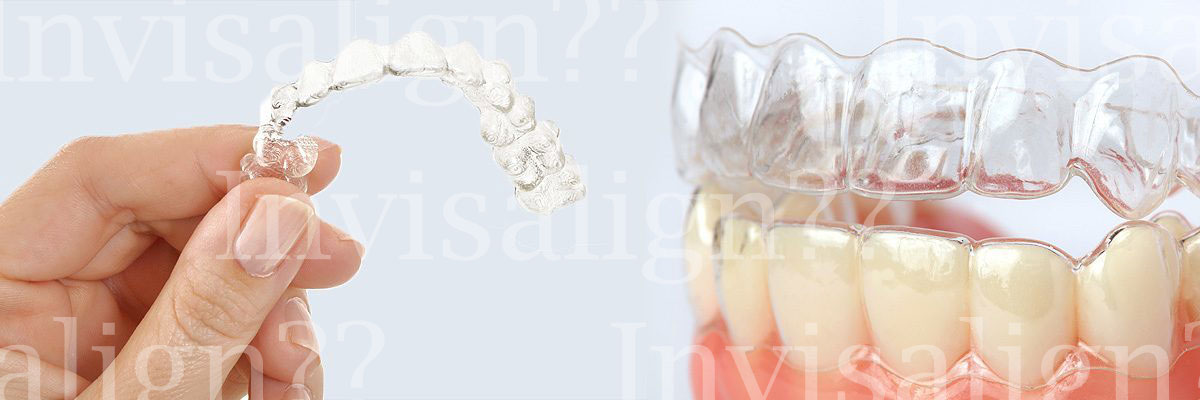 Peoria Does Invisalign® Really Work?