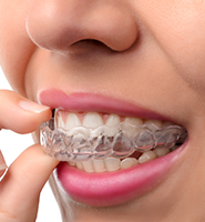 Clear Aligners - Almost Invisible Braces Peoria, AZ