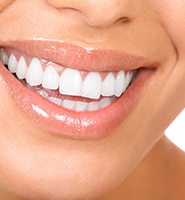 Teeth Whitening Services Peoria, AZ