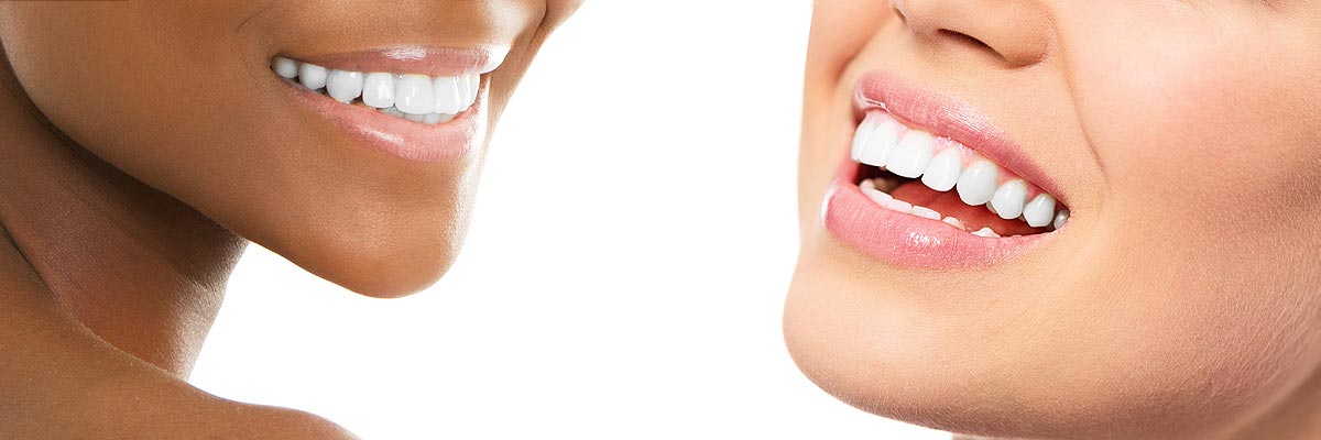 Peoria Teeth Whitening