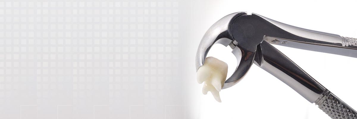 Peoria Tooth Extraction
