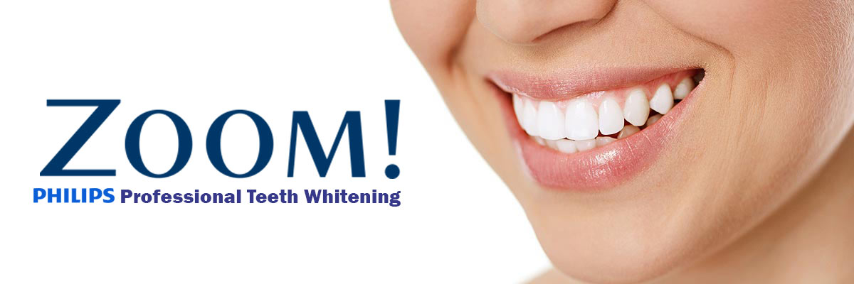 Peoria Zoom Teeth Whitening